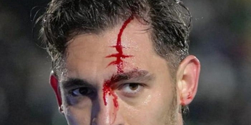 Είναι θέμα αποδυτηρίων